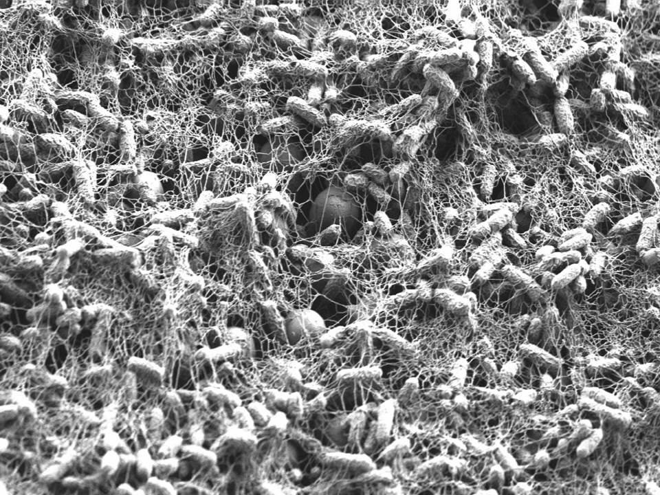 Bacterial communities on periodic nanostructures 3
