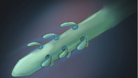 catheter