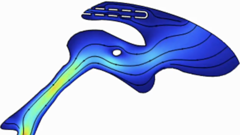 hydrocephalus_sim